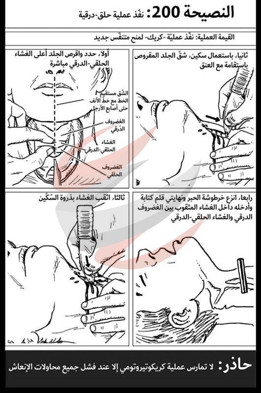 نصائح الإسعافات الأولية والجراحية