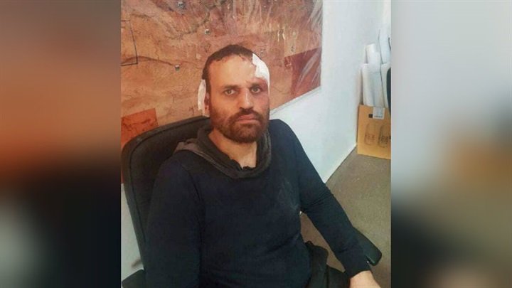 التأثيرات المستقبلية