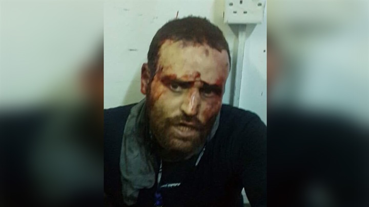 التأثيرات المستقبلية